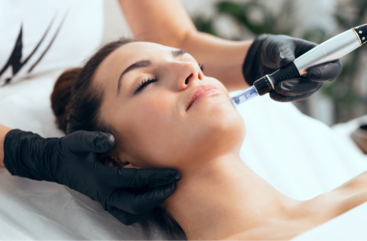 Services Microneedling Feature Image