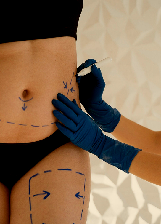 Fat Dissolving Therapy Aftercare Recovery Img